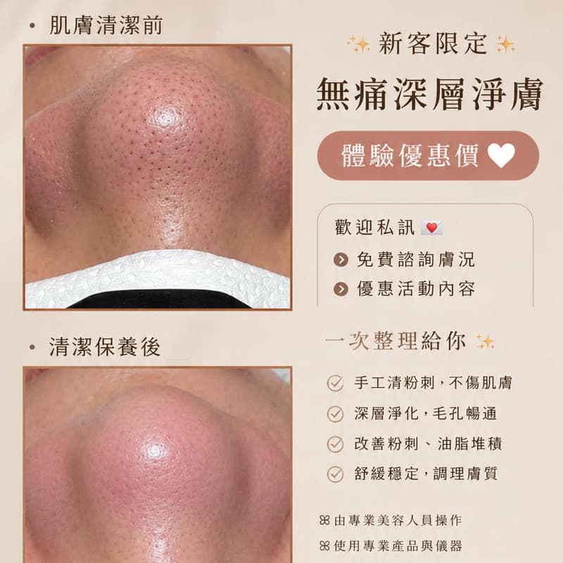 毛孔深層大掃除