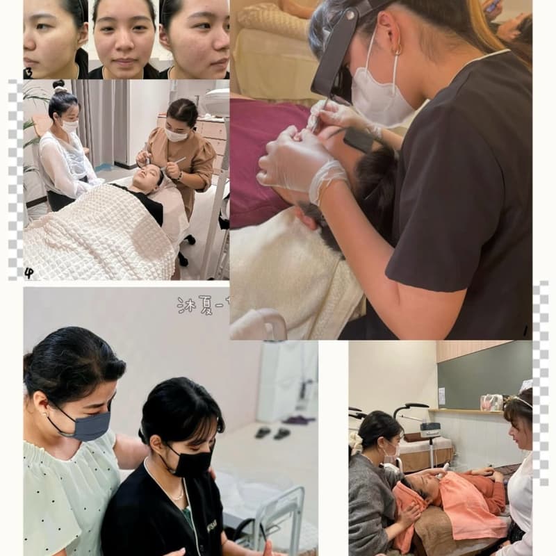 誠徵粉刺模特兒
