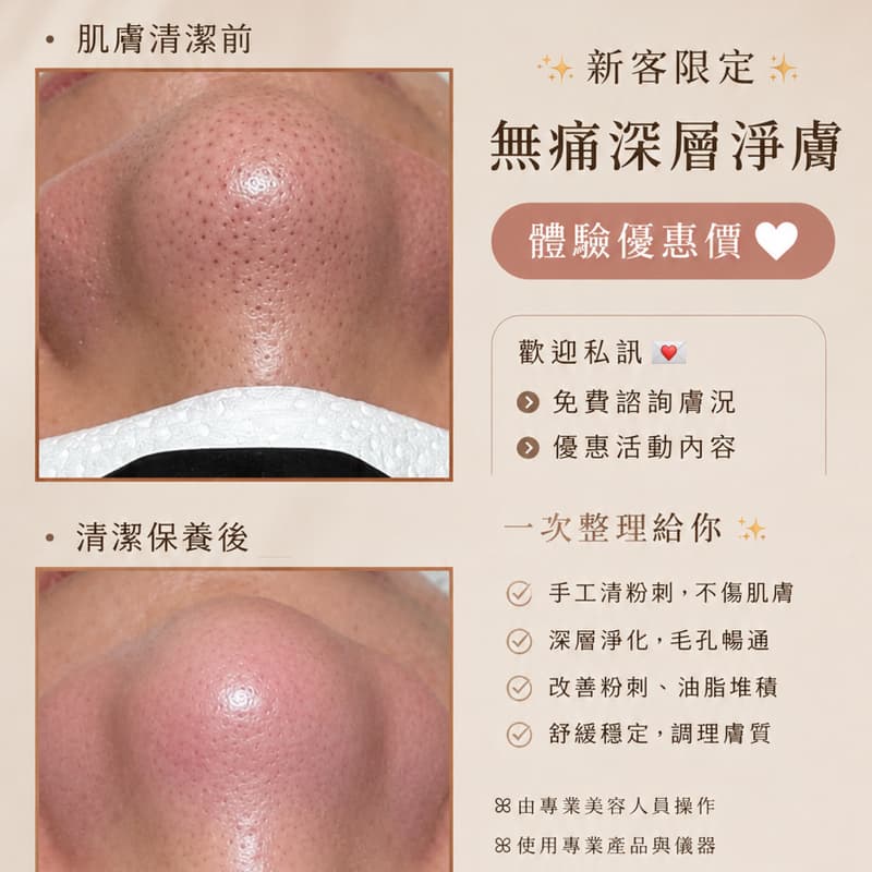 毛孔深層大掃除→ 體驗價599